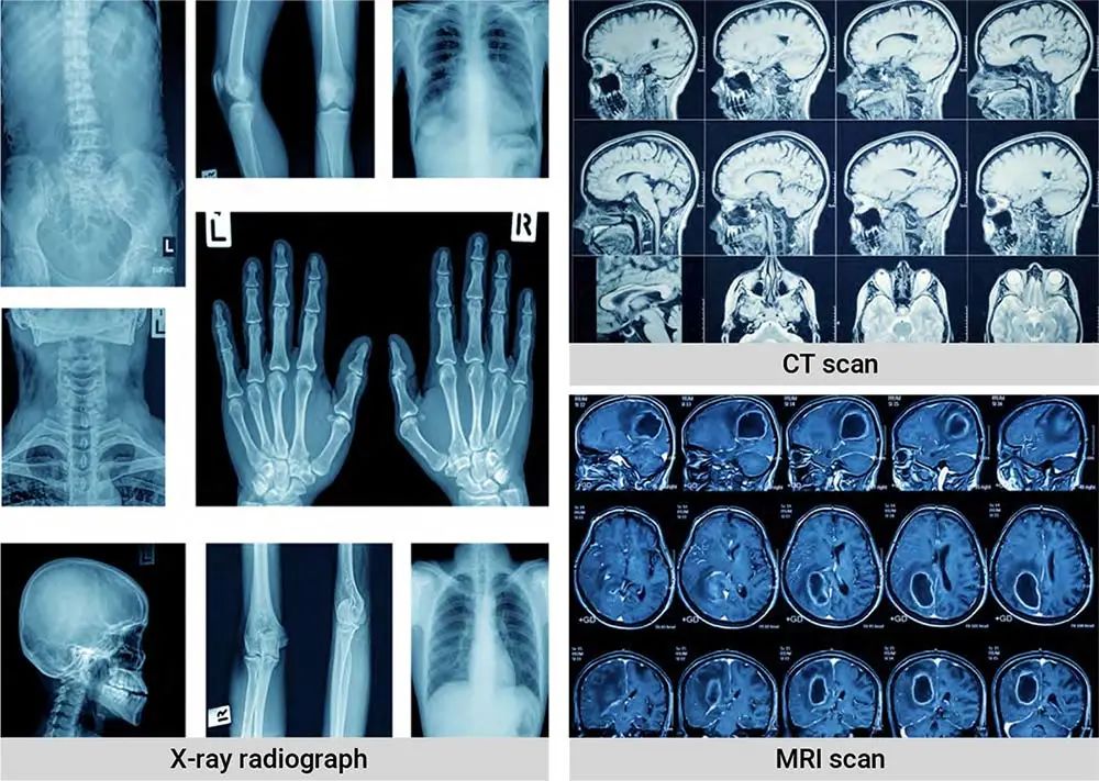 移動式醫(yī)用X射線機(jī) 1.jpg